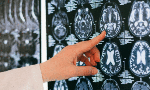 doctor revisando tomografia