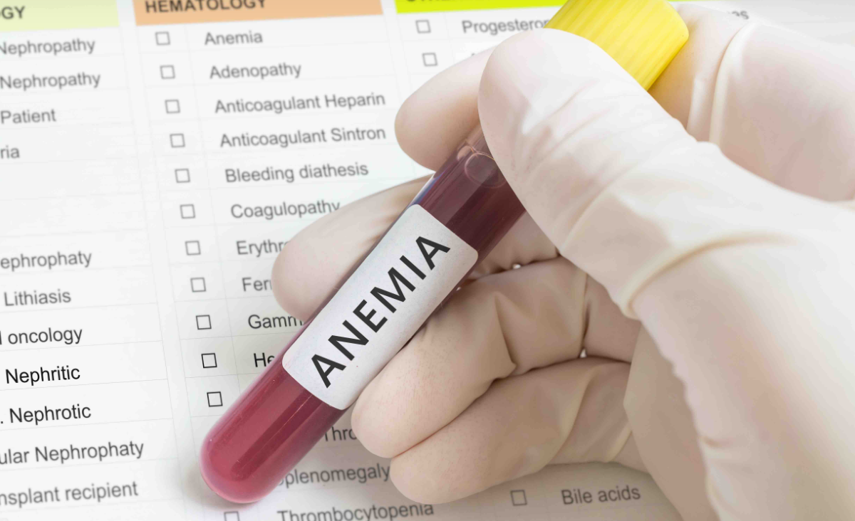 tubo de sangre para muestra de anemia