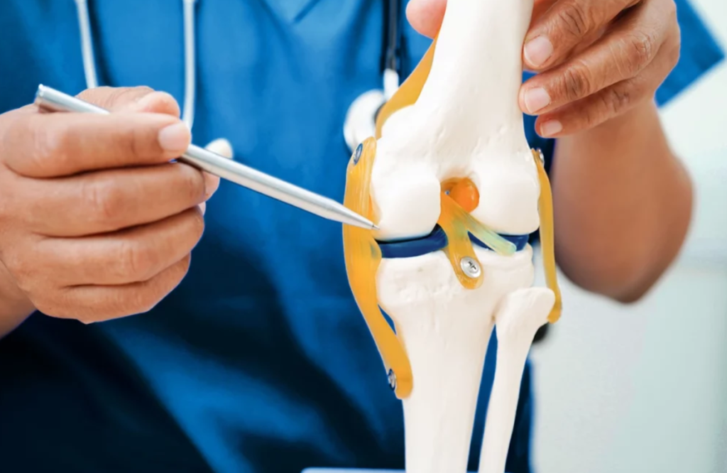 doctor con modelo anatómico de rodilla con osteoartritis